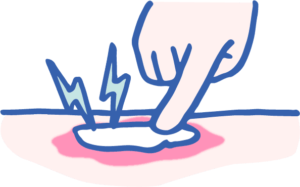 薬のすり込みで起こる問題