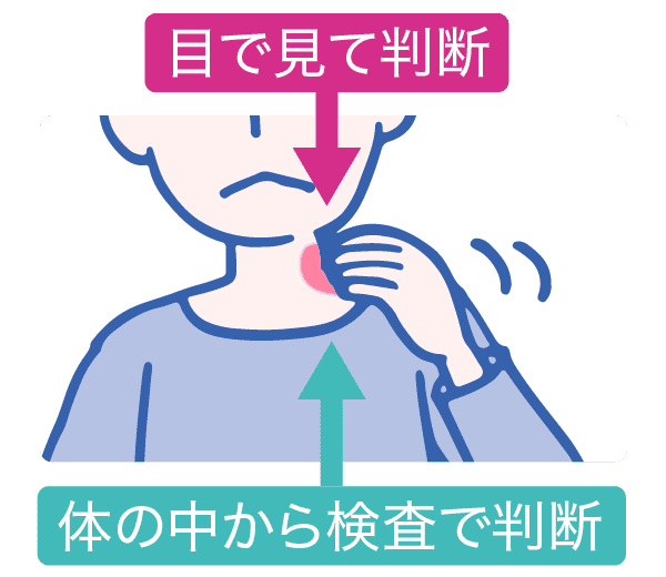 目で見て判断　体の中から検査で判断