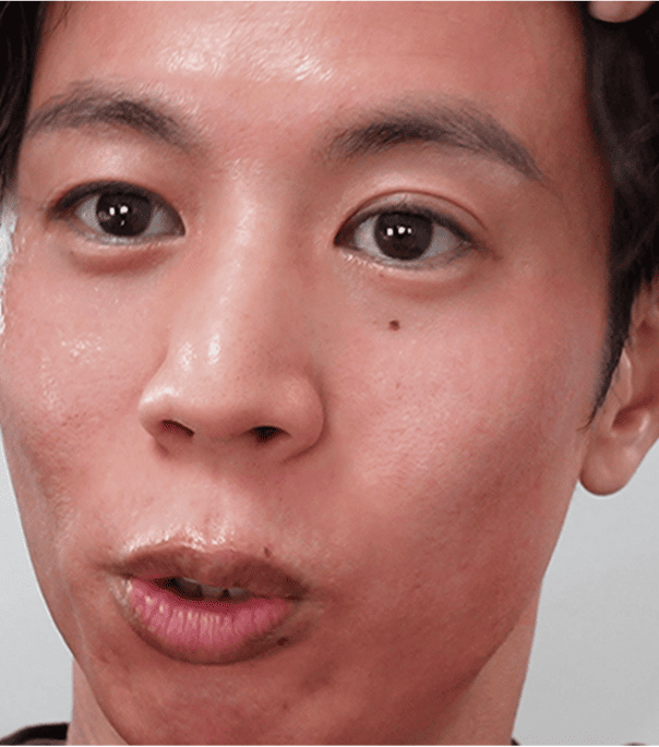 患者さんの声 