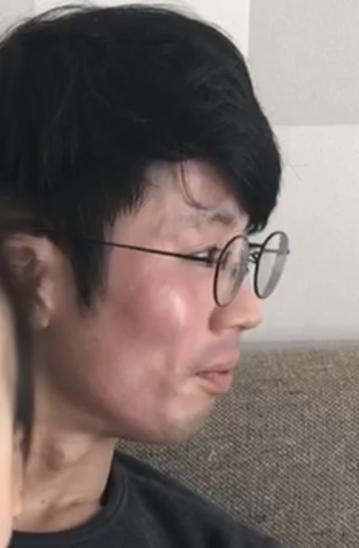 患者さんの声