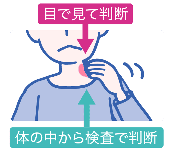 目で見て判断　体の中から検査で判断