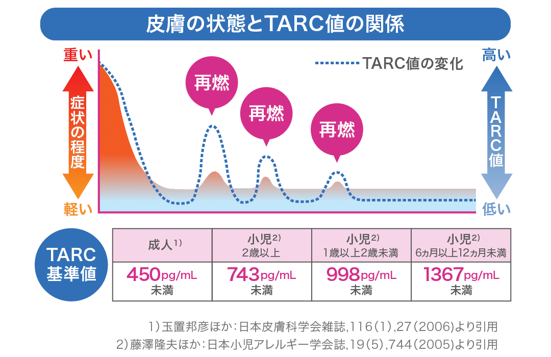 皮膚の炎症が重いとTARC検査の数値が高くなり、