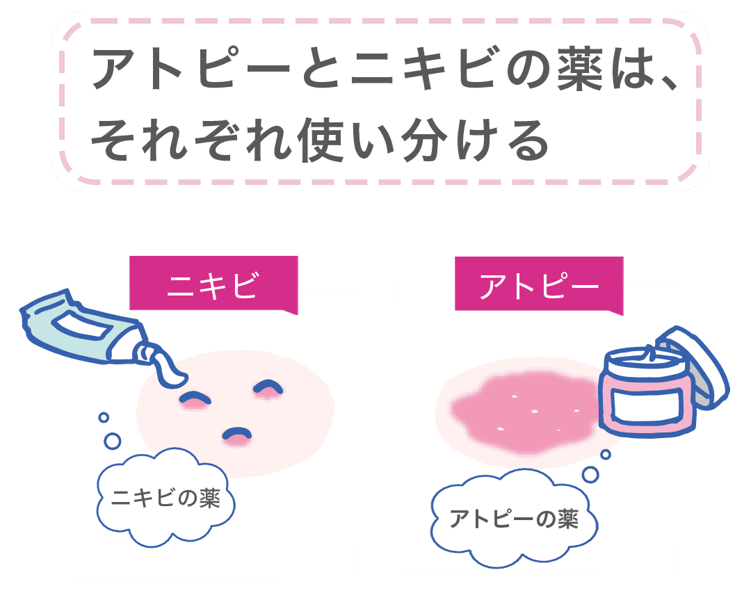 アトピーとニキビの薬は、それぞれ使い分ける