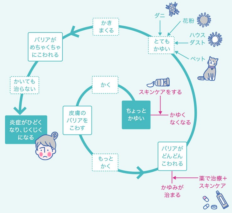 アトピーのかゆみのメカニズム