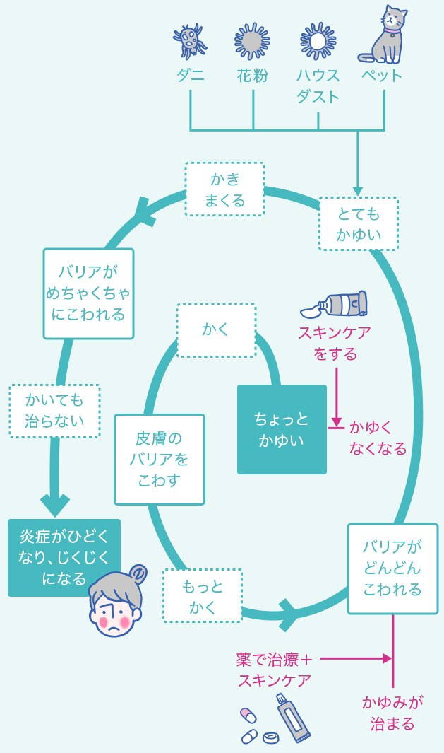 アトピーのかゆみのメカニズム